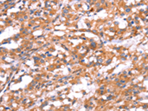 Rabbit Polyclonal Antibody to GABBR1