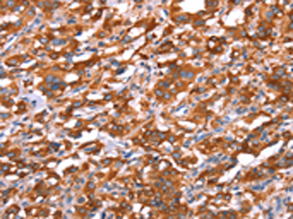 Rabbit Polyclonal Antibody to GAS8