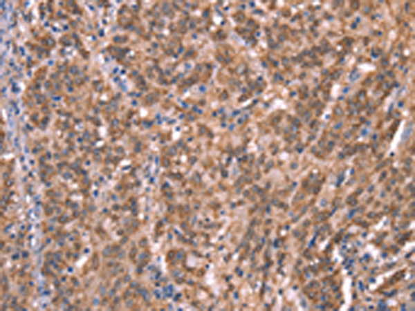 Rabbit Polyclonal Antibody to GCSAM