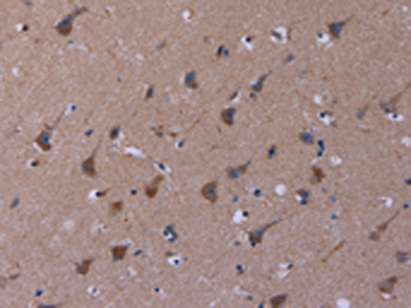 Rabbit Polyclonal Antibody to TUBGCP2