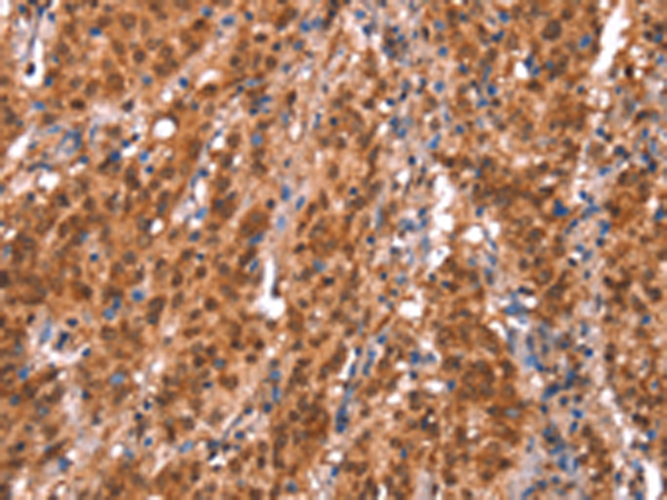Rabbit Polyclonal Antibody to KCNJ6