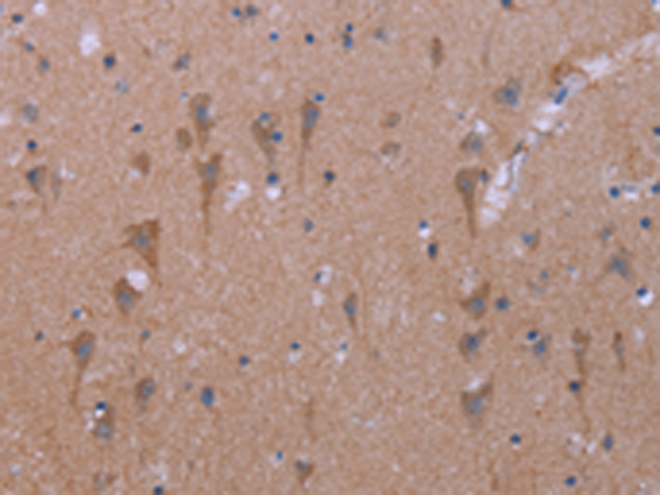 Rabbit Polyclonal Antibody to KCNJ9