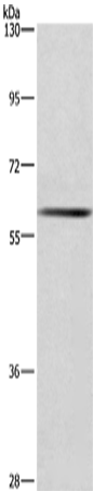 Rabbit Polyclonal Antibody to GCKR
