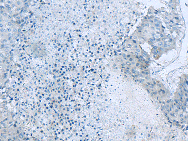 Rabbit Polyclonal Antibody to GLS