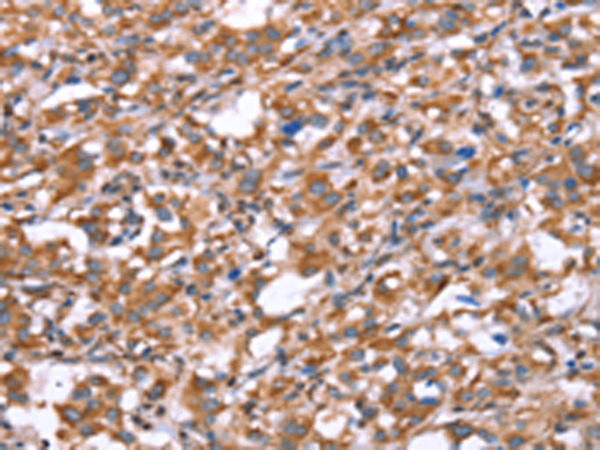 Rabbit Polyclonal Antibody to GPC6