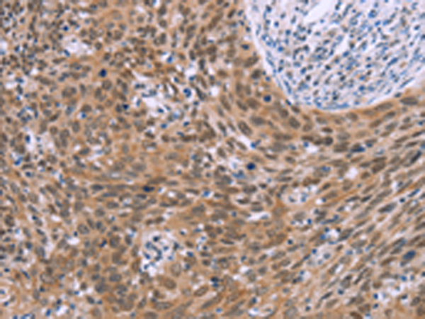 Rabbit Polyclonal Antibody to GLYR1