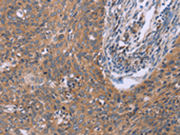 Rabbit Polyclonal Antibody to CSF2RB