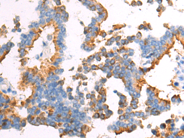 Rabbit Polyclonal Antibody to GNAT3