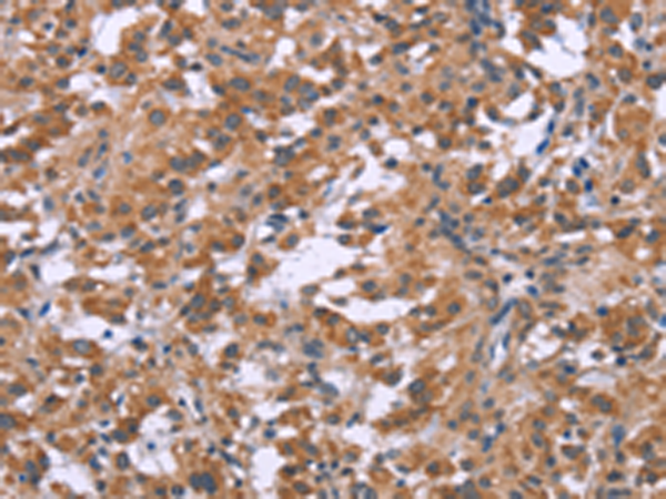 Rabbit Polyclonal Antibody to GNPAT