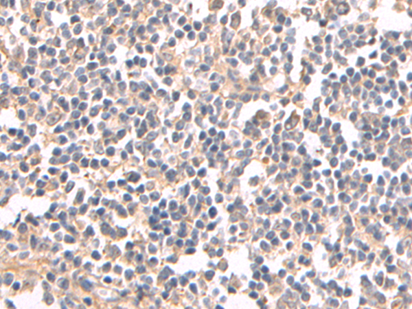 Rabbit Polyclonal Antibody to HCAR2