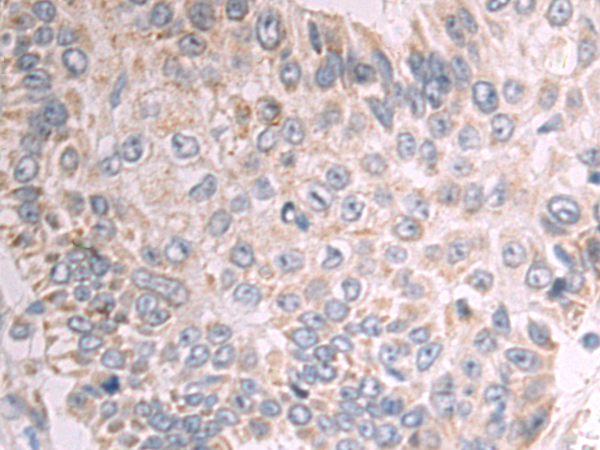 Rabbit Polyclonal Antibody to ADGRA2