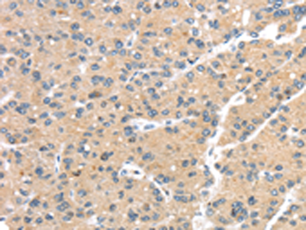 Rabbit Polyclonal Antibody to GPD2