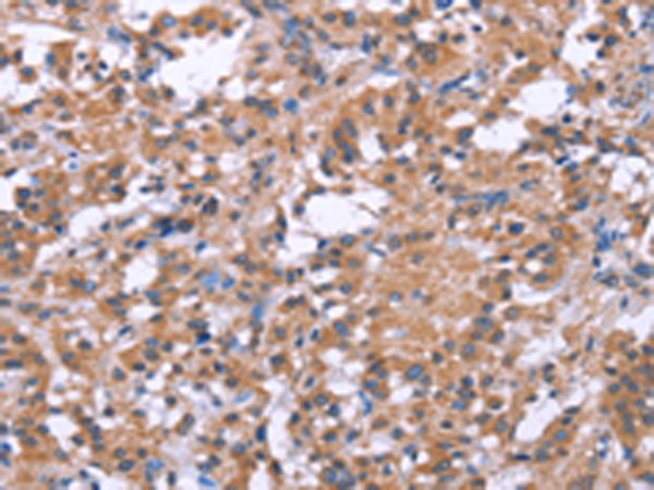 Rabbit Polyclonal Antibody to SLC52A1