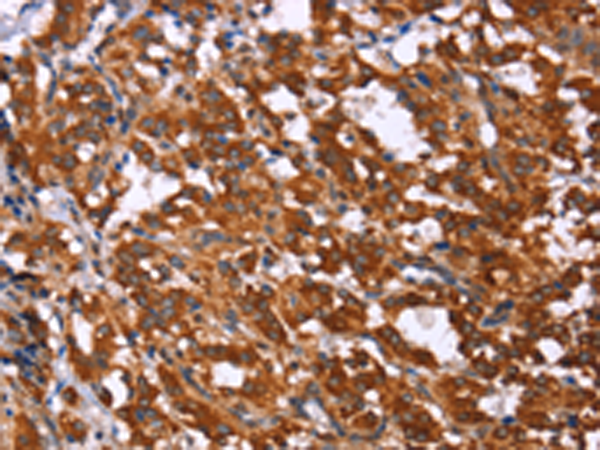 Rabbit Polyclonal Antibody to GPR65