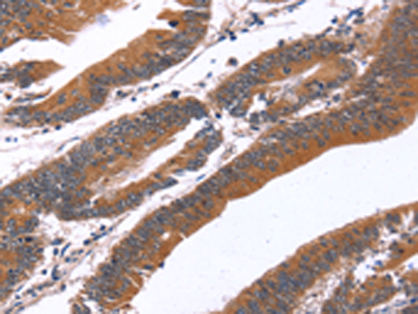 Rabbit Polyclonal Antibody to GREB1