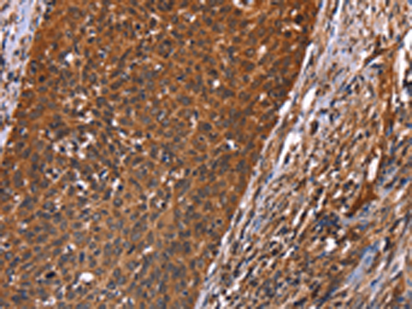 Rabbit Polyclonal Antibody to GUK1
