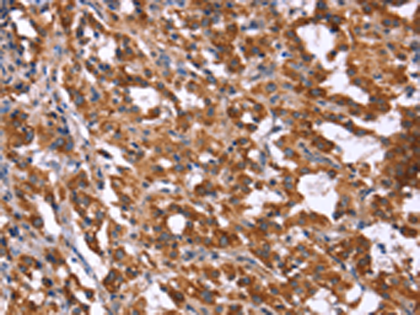 Rabbit Polyclonal Antibody to HACE1