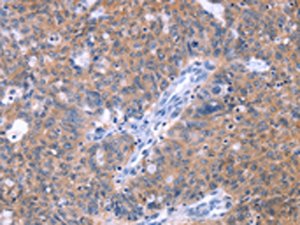 Rabbit Polyclonal Antibody to ZNF395