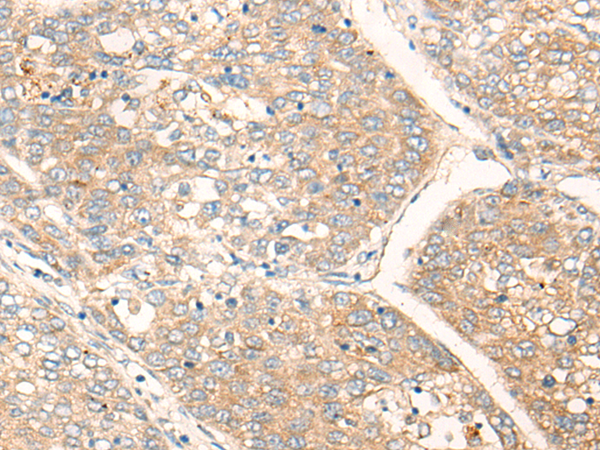Rabbit Polyclonal Antibody to HIPK2