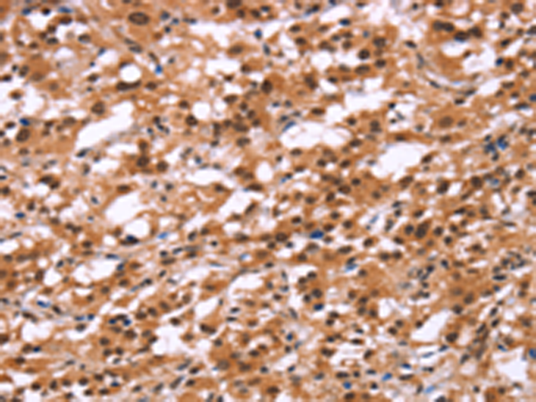 Rabbit Polyclonal Antibody to HIPK1