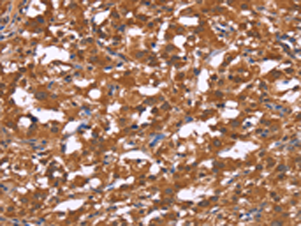 Rabbit Polyclonal Antibody to HLTF