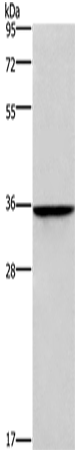 Rabbit Polyclonal Antibody to HOXB2