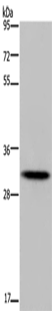 Rabbit Polyclonal Antibody to HOXB8