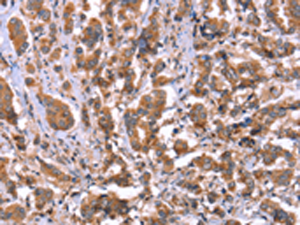 Rabbit Polyclonal Antibody to HRG