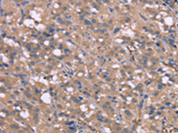 Rabbit Polyclonal Antibody to HP