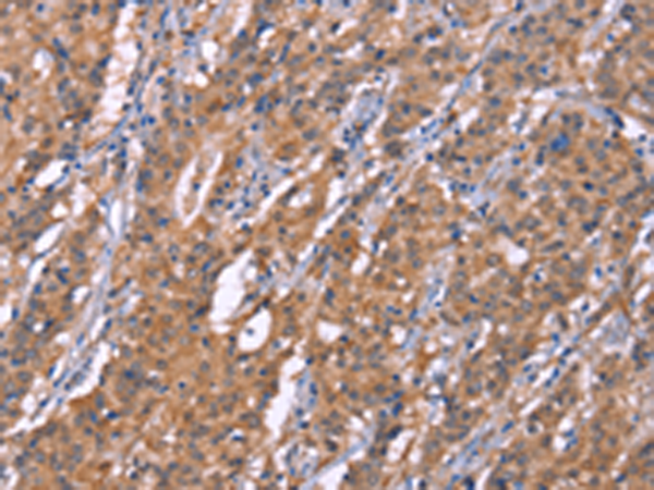 Rabbit Polyclonal Antibody to PLAAT2