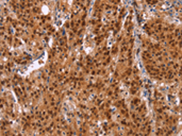 Rabbit Polyclonal Antibody to HRK