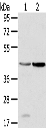 Rabbit Polyclonal Antibody to HSD11B2