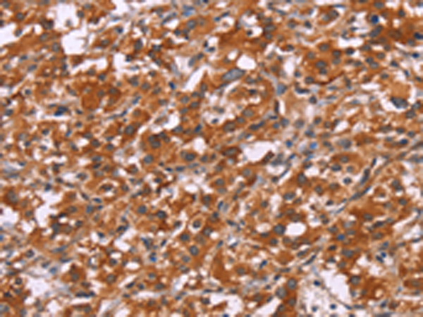 Rabbit Polyclonal Antibody to HSPB6