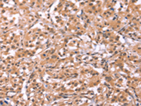 Rabbit Polyclonal Antibody to ID2