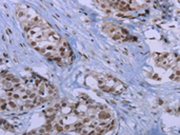 Rabbit Polyclonal Antibody to ID3