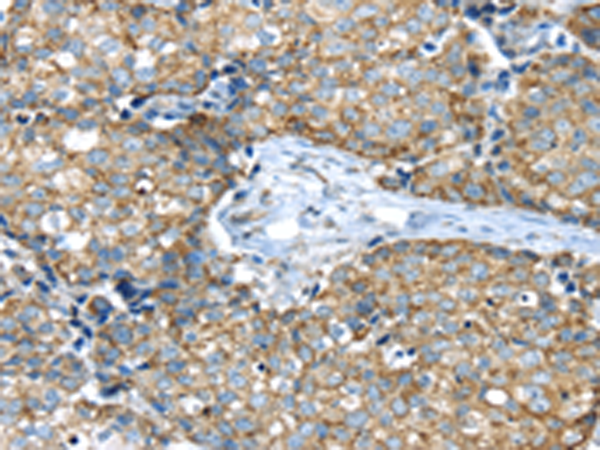 Rabbit Polyclonal Antibody to IFNA2