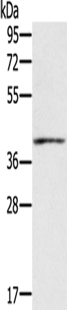 Rabbit Polyclonal Antibody to IFNGR2