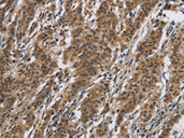 Rabbit Polyclonal Antibody to IL12RB2