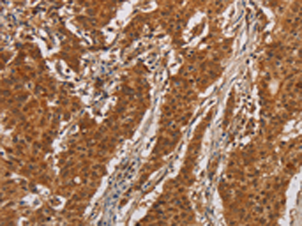 Rabbit Polyclonal Antibody to IL17RA