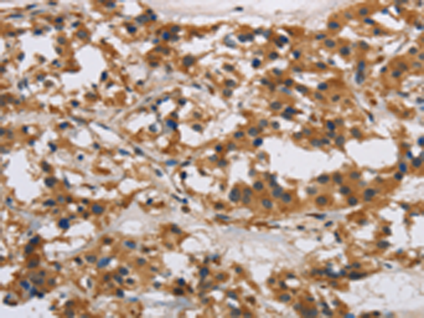 Rabbit Polyclonal Antibody to IL17RB