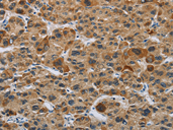 Rabbit Polyclonal Antibody to IL31