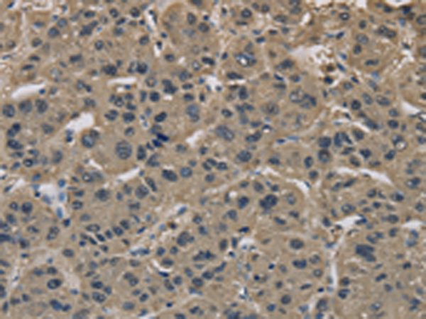 Rabbit Polyclonal Antibody to IMPAD1