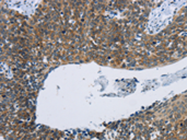 Rabbit Polyclonal Antibody to KPNB1