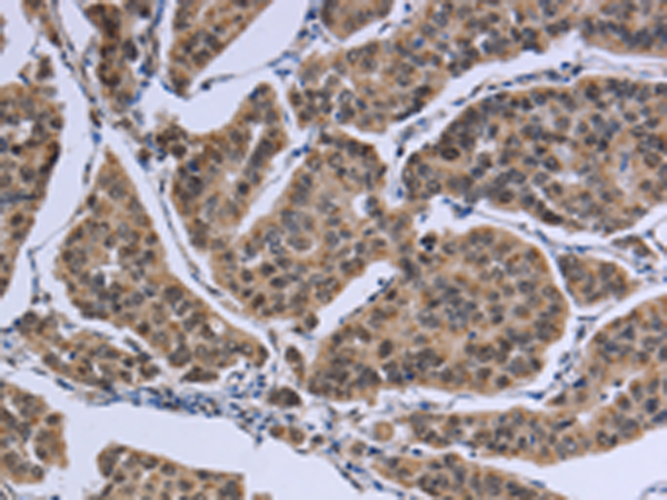 Rabbit Polyclonal Antibody to IPO8