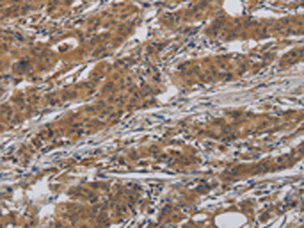 Rabbit Polyclonal Antibody to INPPL1