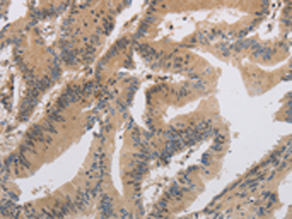 Rabbit Polyclonal Antibody to ITIH1
