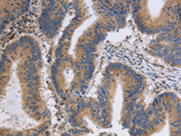 Rabbit Polyclonal Antibody to ITPR1