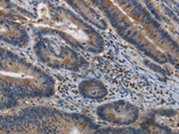 Rabbit Polyclonal Antibody to ITPR2