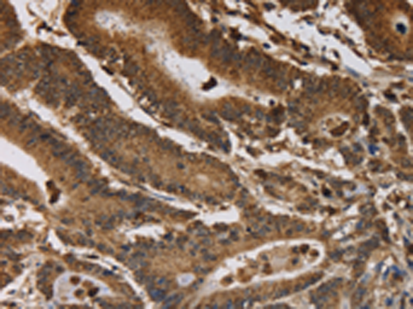 Rabbit Polyclonal Antibody to ITPR3