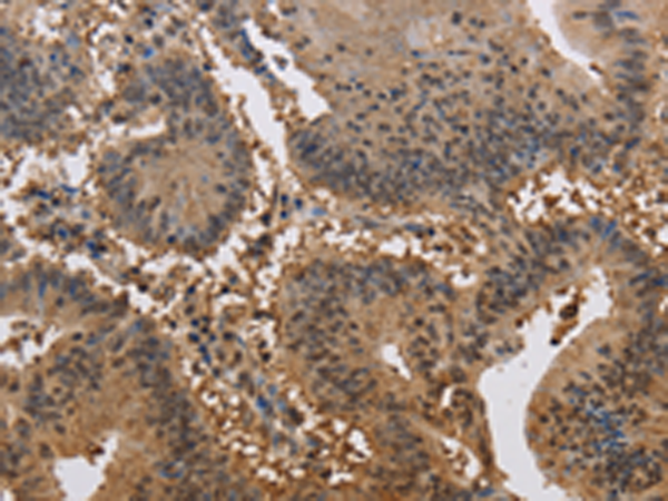 Rabbit Polyclonal Antibody to JAG2